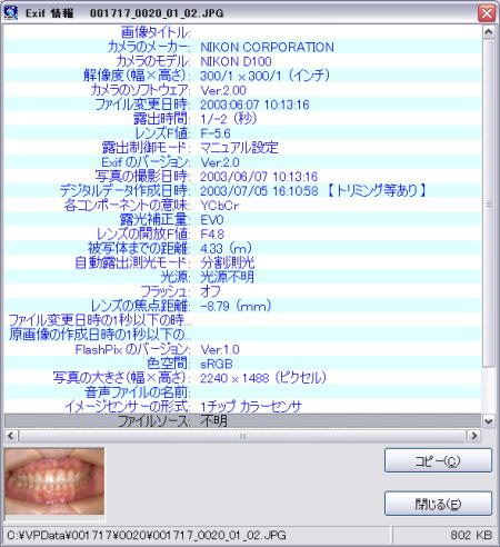 歯科インフォームドコンセント用デジタル画像管理ソフト VPシステム　Exif表示機能
