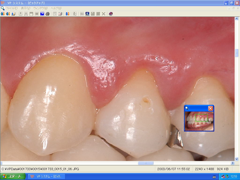 歯科インフォームドコンセント用デジタル画像管理ソフト VPシステム ピックアップ画面