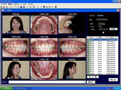 歯科インフォームドコンセント用デジタル画像管理ソフト VPシステム　シート表示画面