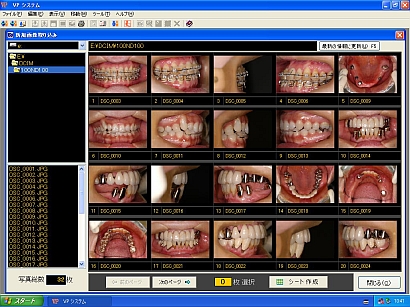 歯科インフォームドコンセント用デジタル画像管理ソフト VPシステム　取り込み画面